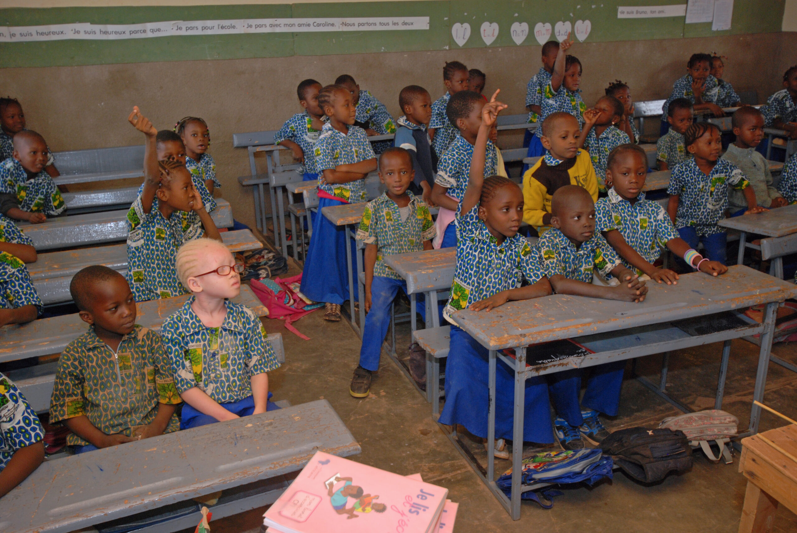 kind met albinisme in klas